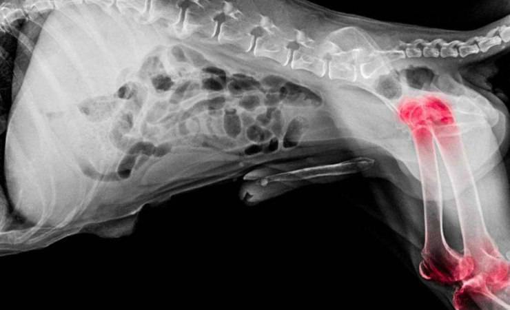 radiografía de cadera